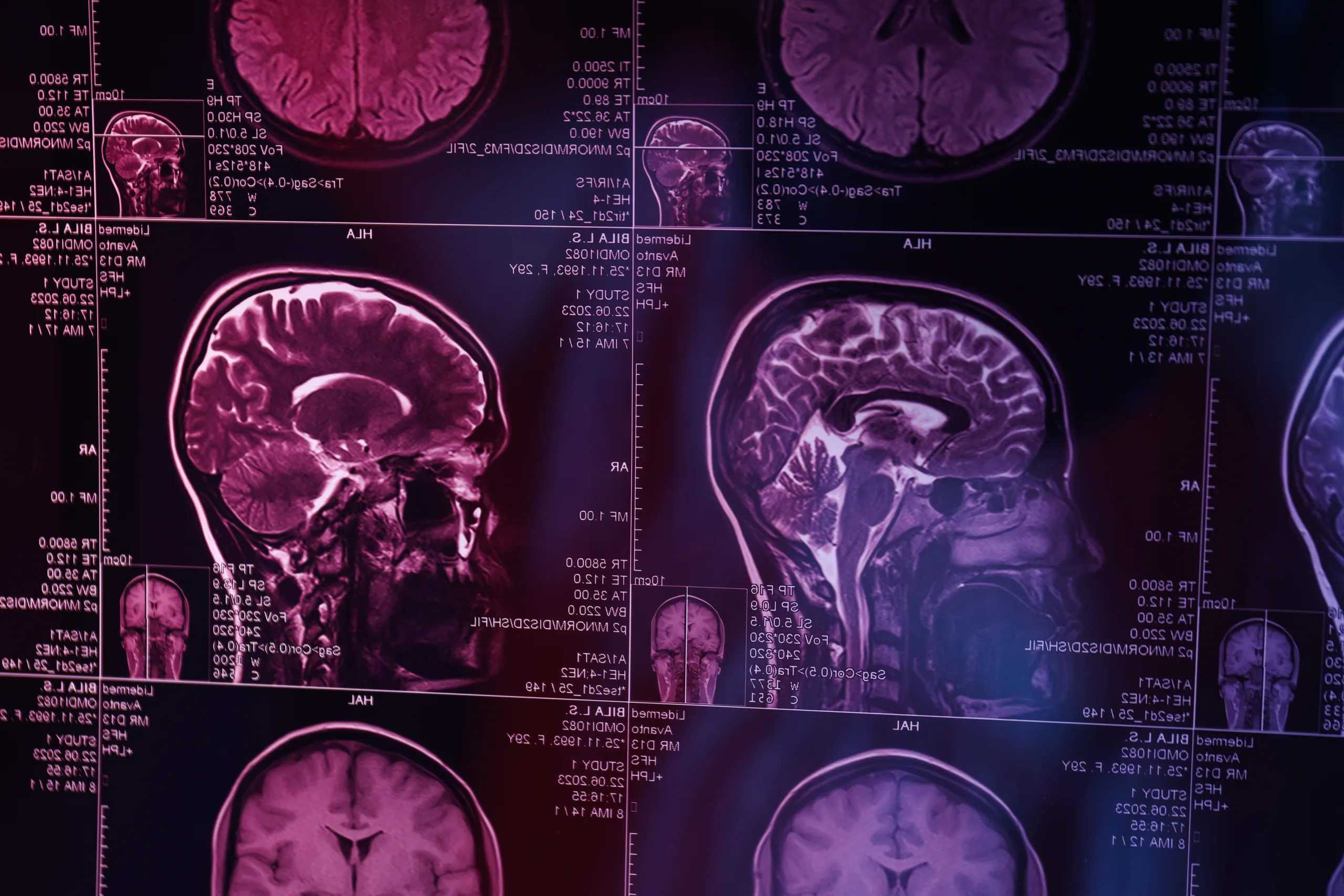 Ecografías portátiles y teleconsultas: El plan de la UDLA para reducir la falta de neurólogos en la región