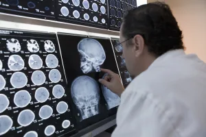 Cuando el cáncer llega al cerebro: dos investigaciones de la UDLA abren nuevos frentes en el tratamiento